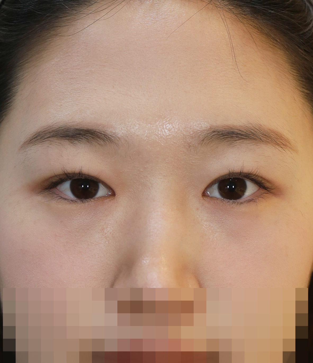 After