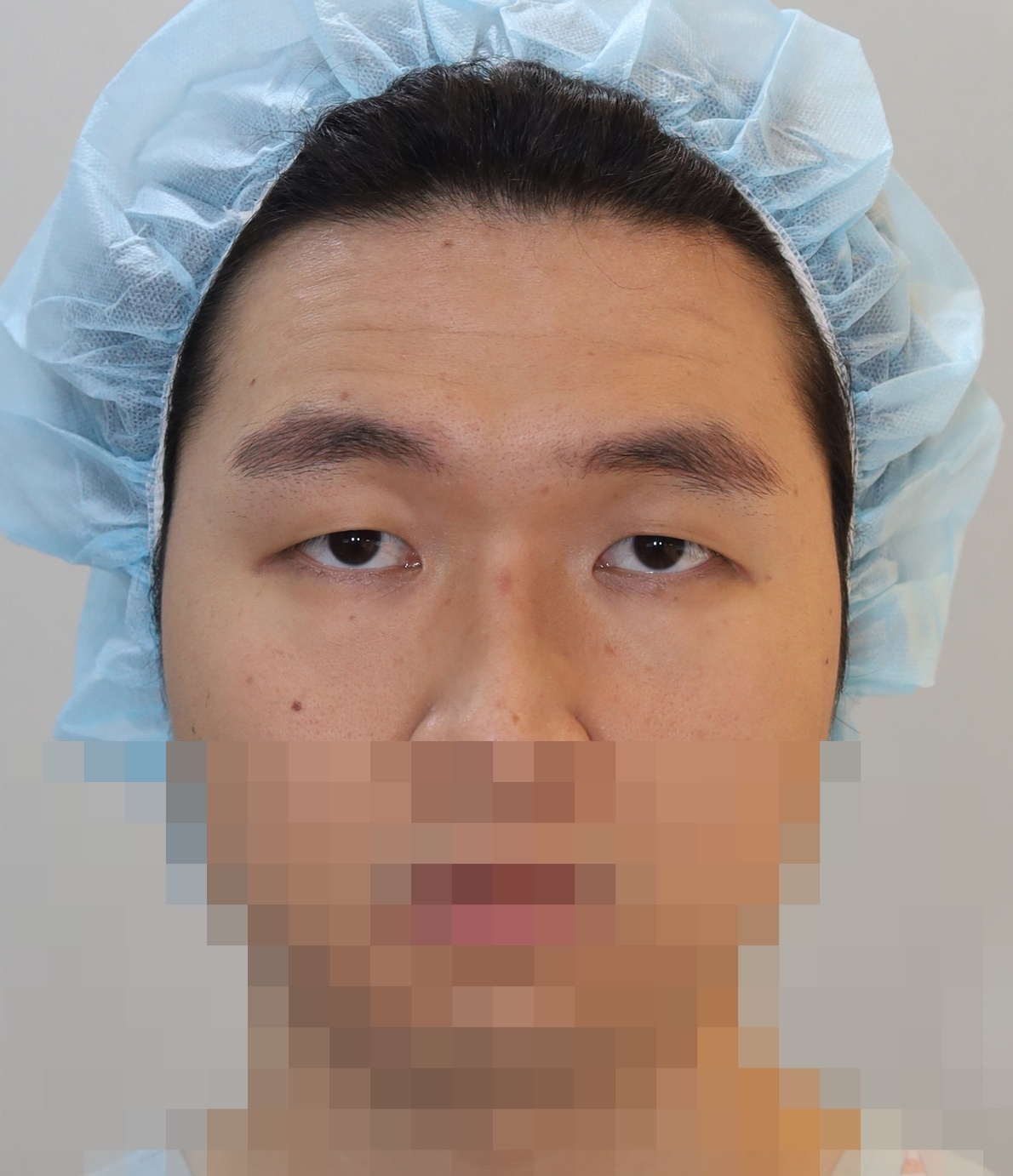Before