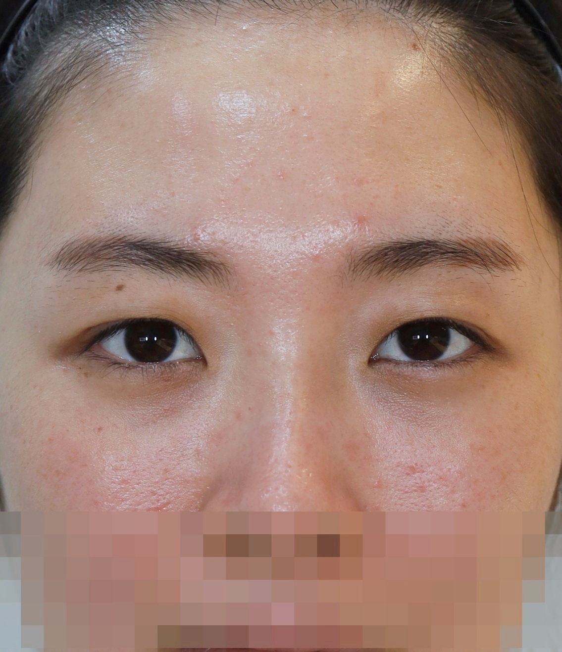 After