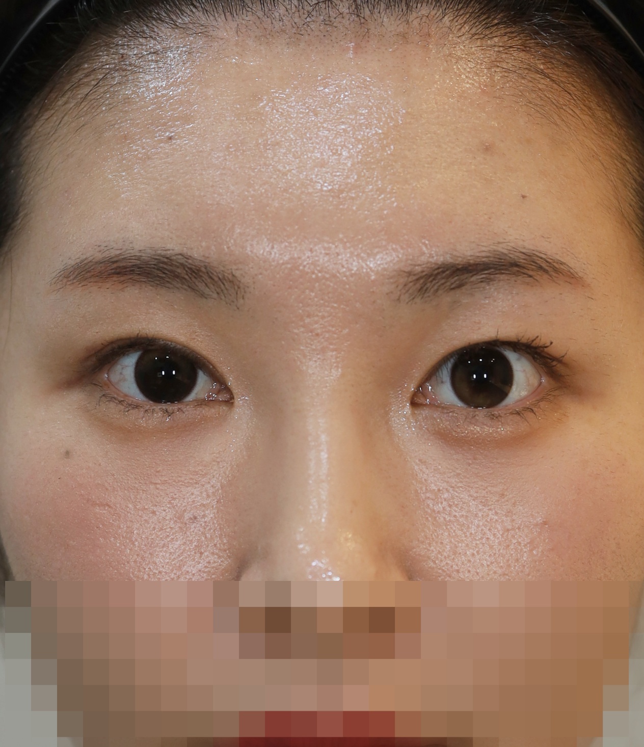 After