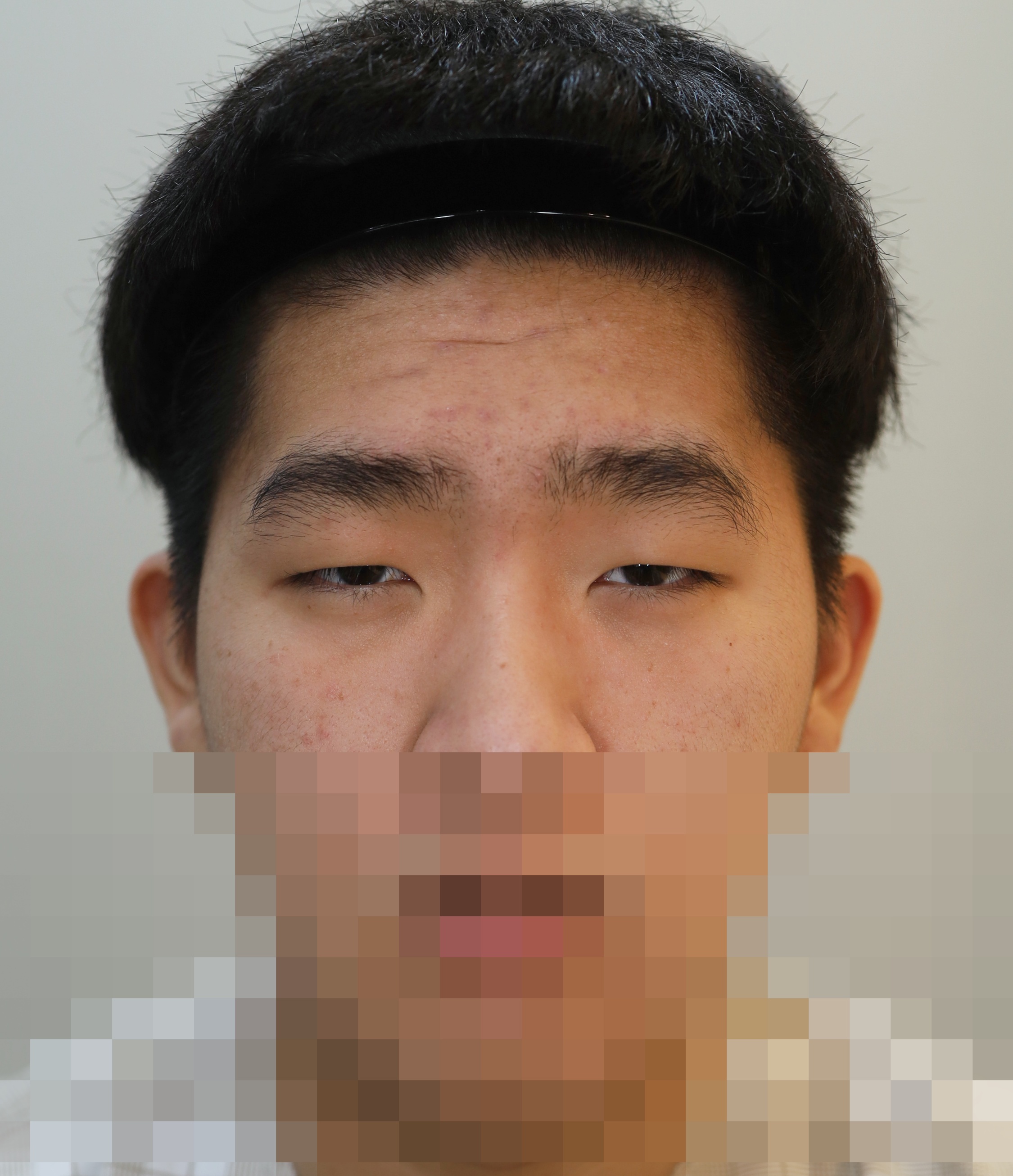 Before
