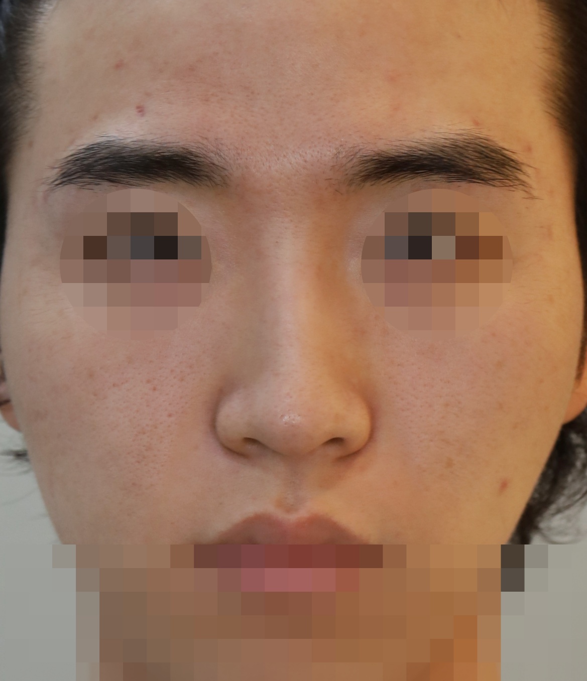Before