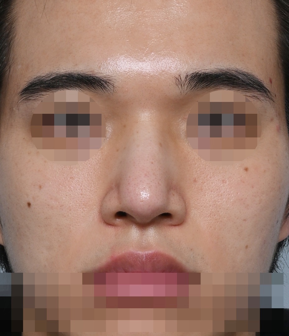 After
