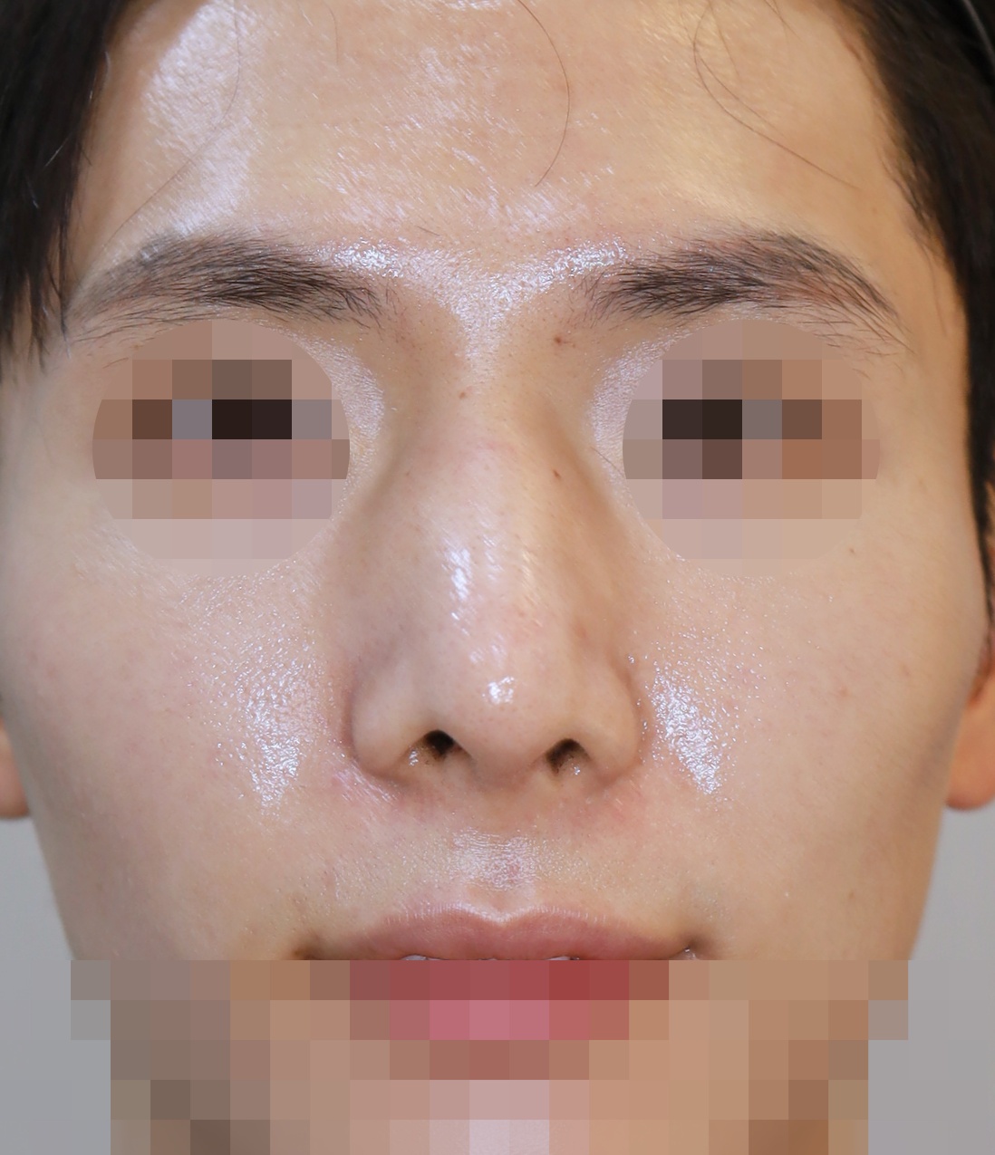 After