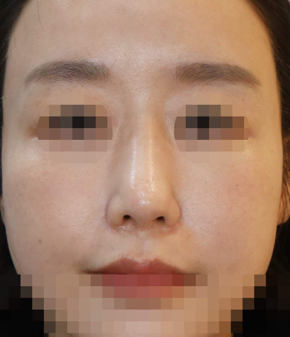 After
