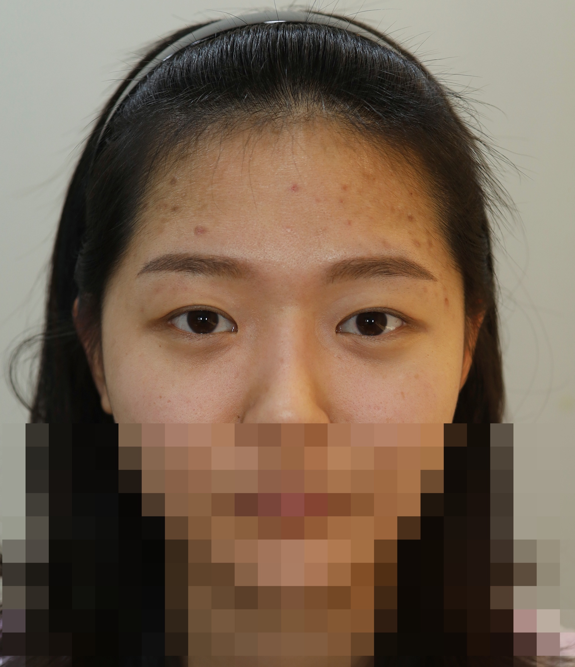 Before