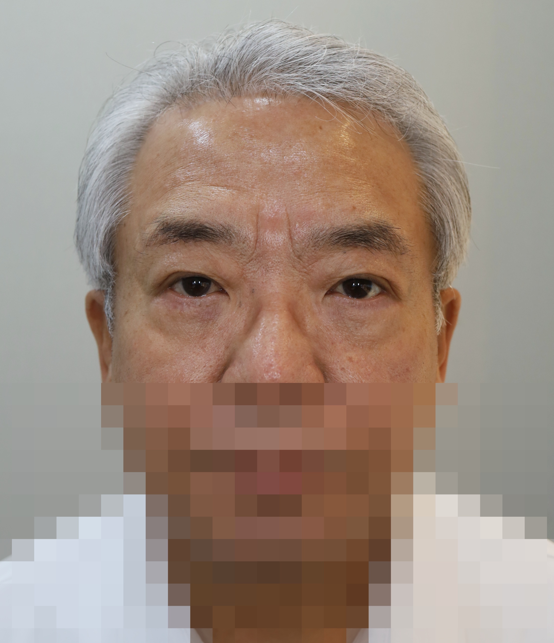 After