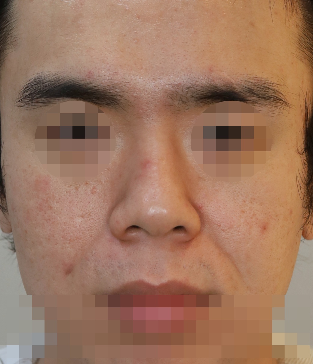 Before