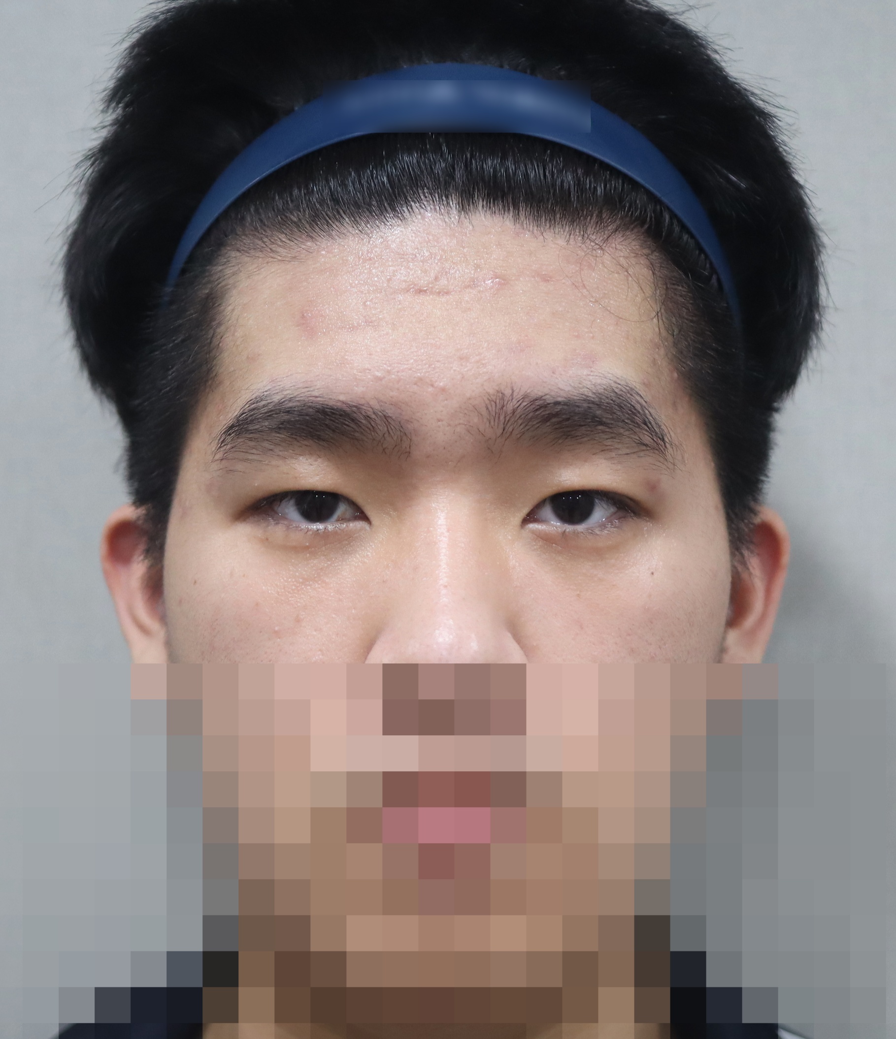 After