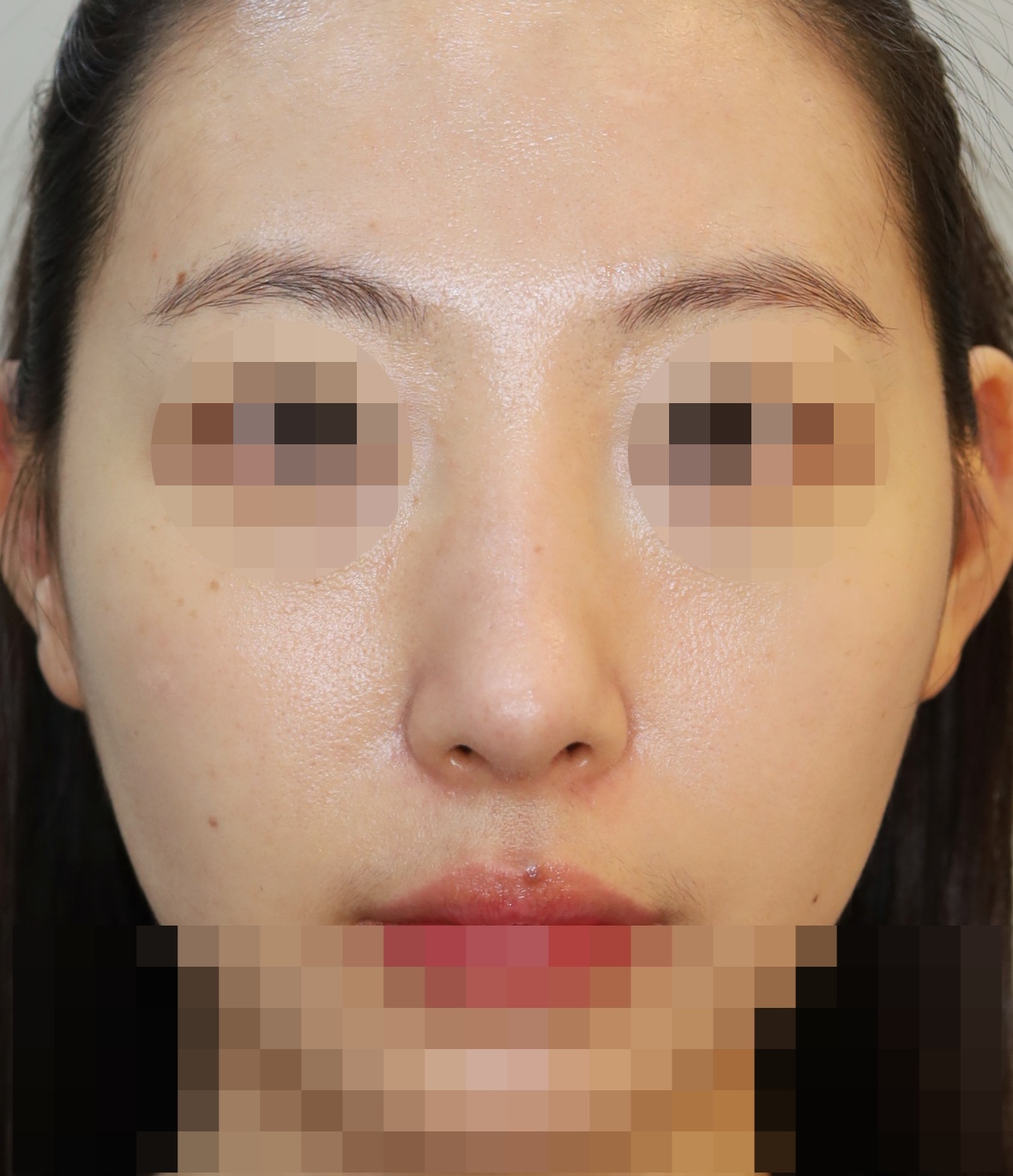 After
