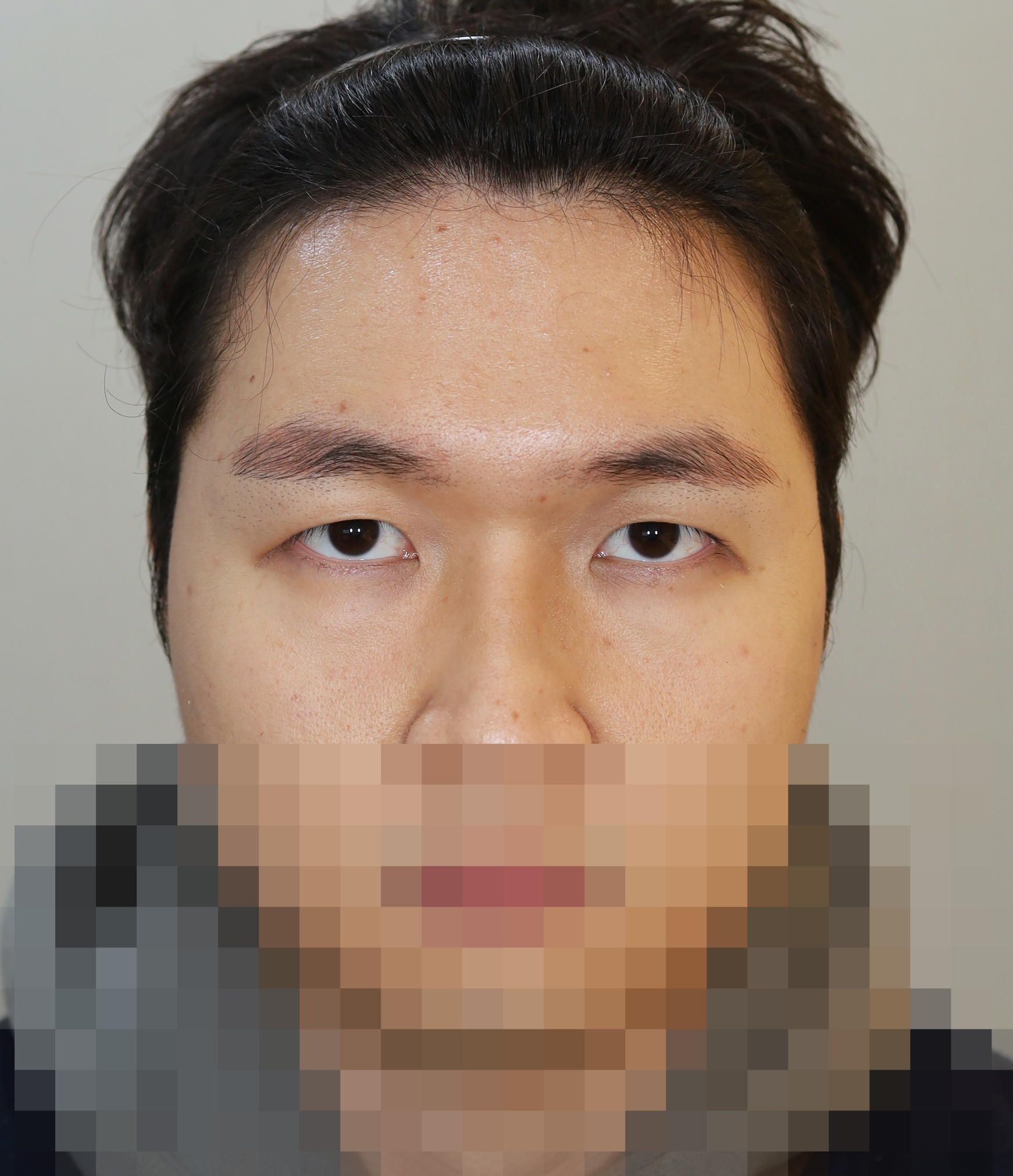 After