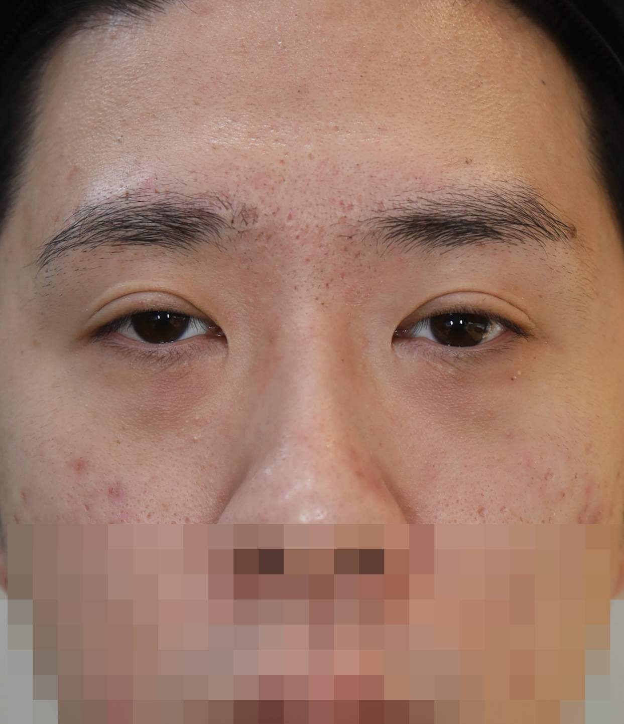 Before
