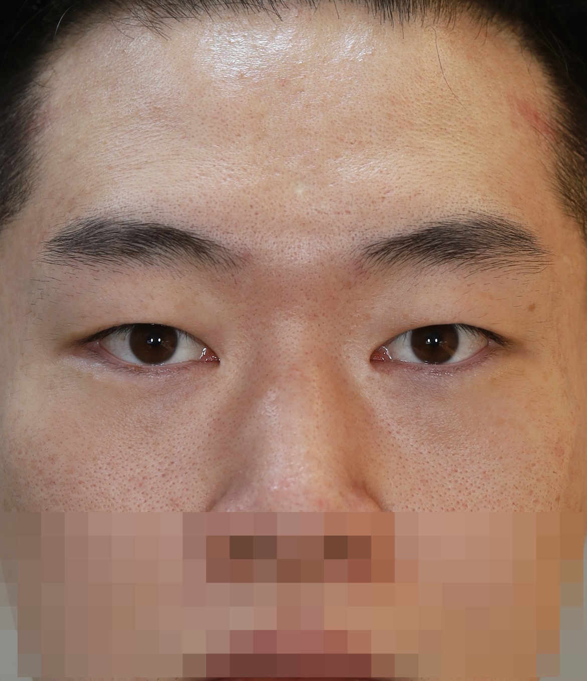 After