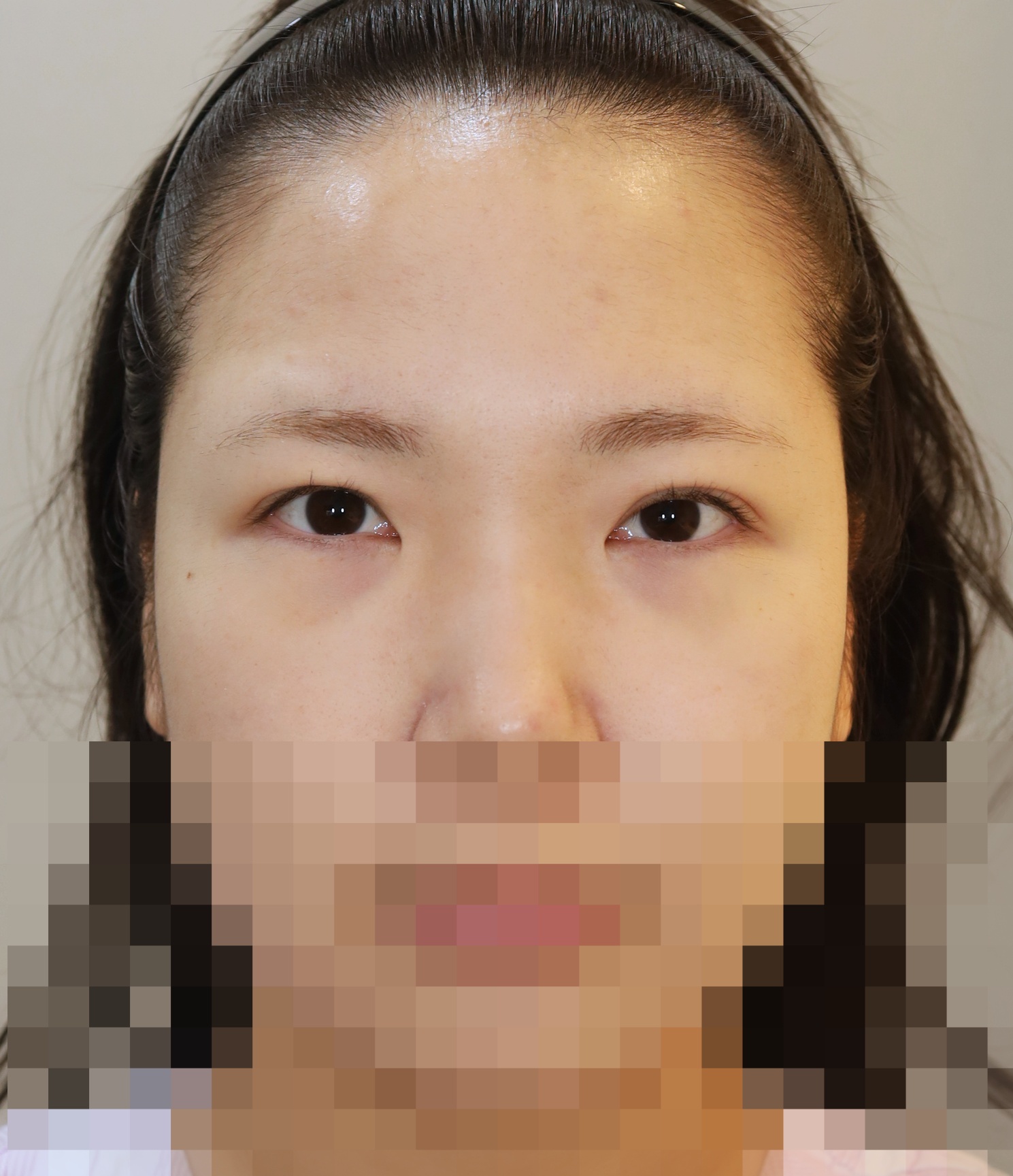 Before