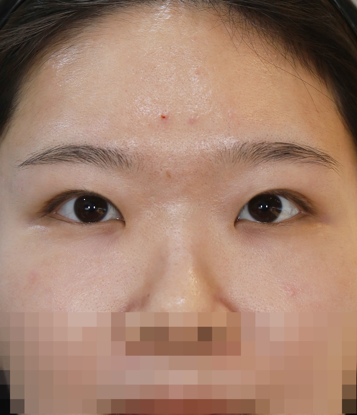 After