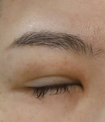 before 사진