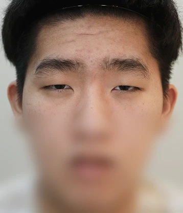before 사진